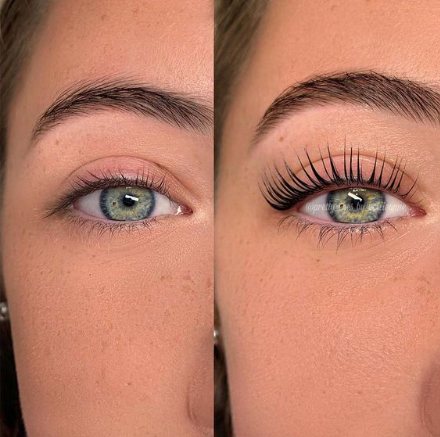 Vitamin D3 treatment image