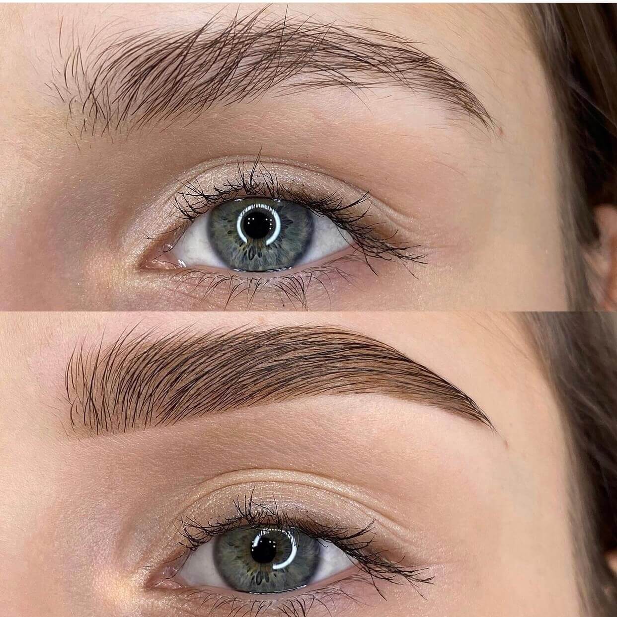 Vitamin D3 treatment image