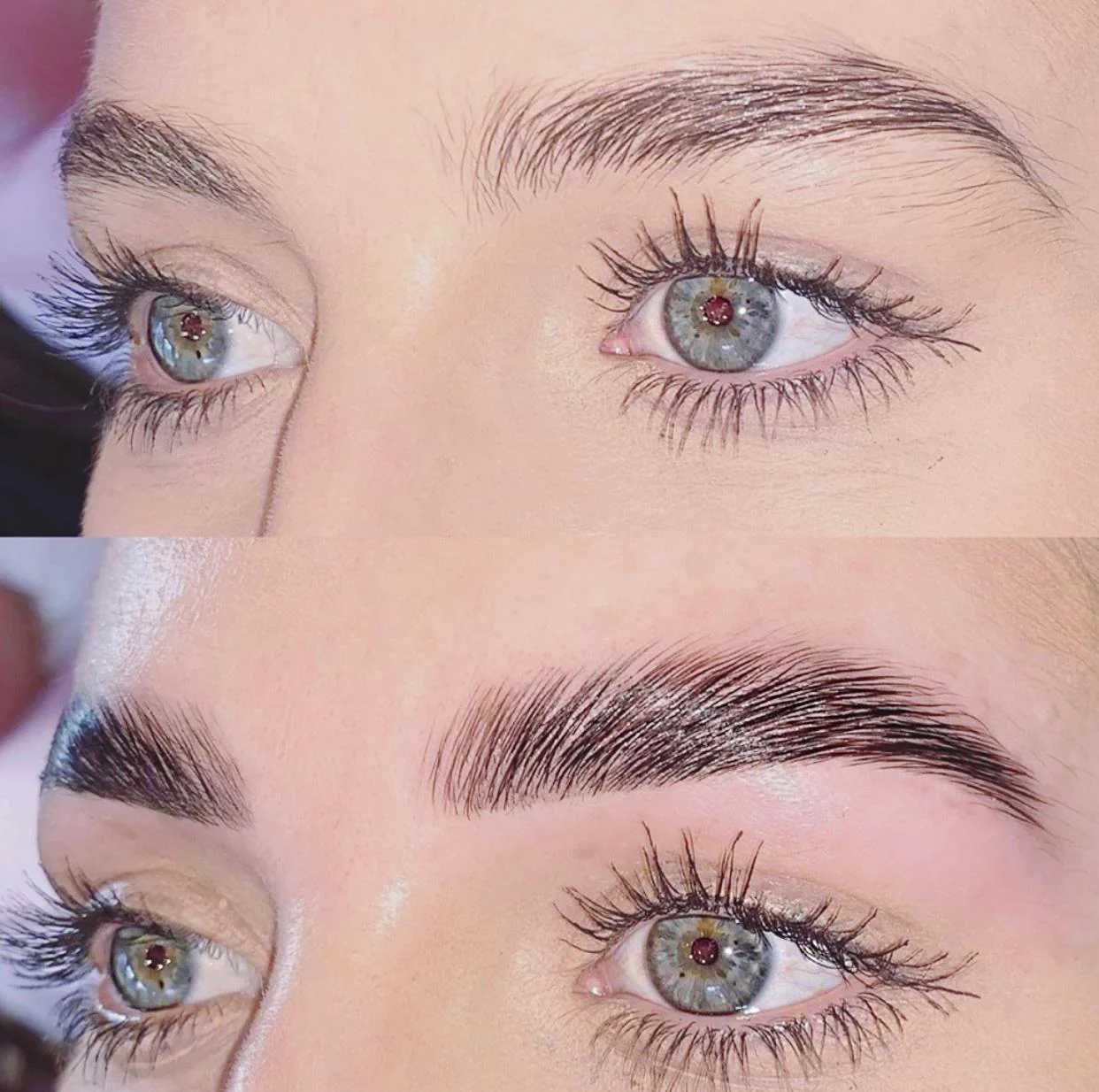 Vitamin D3 treatment image