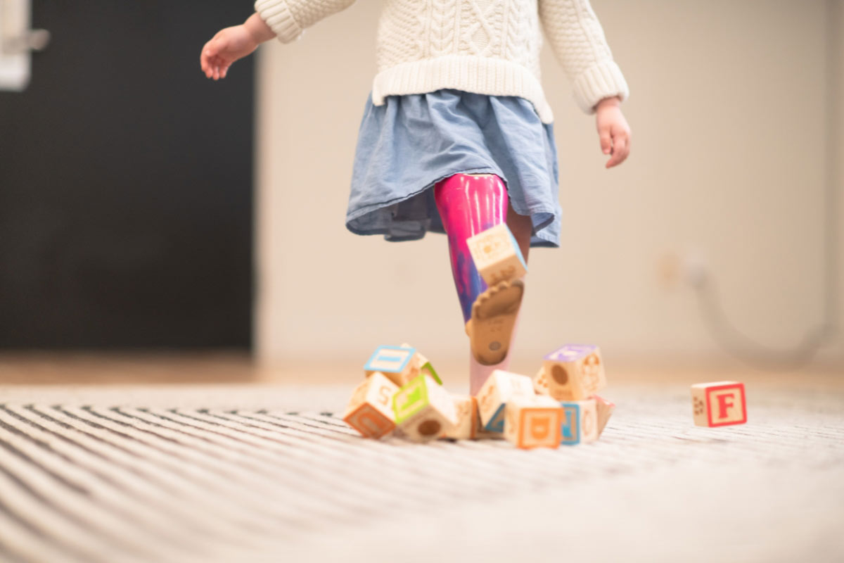 Young child wearing a colorful leg prosthesis steps over wooden alphabet blocks while playing on the floor.