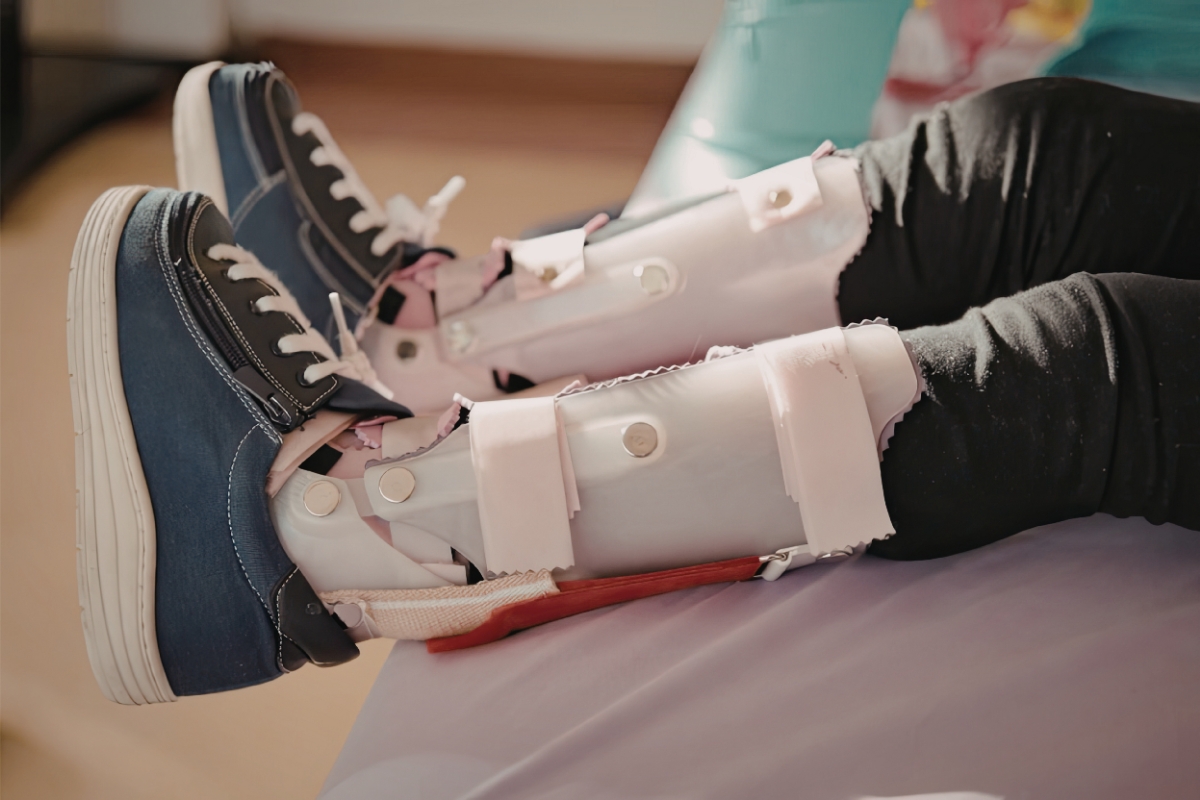 close up view of sitting patient's legs wearing two custom ankle foot orthotics to stabilize movement and growth