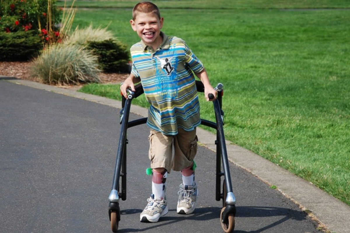 Close-up of a child’s legs in orthotic braces, highlighting the structure and purpose of orthotic devices.