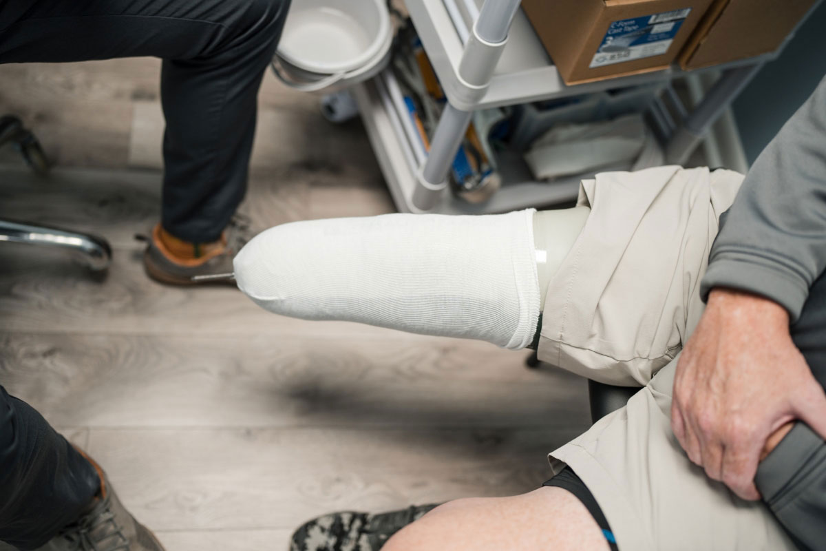 Patient wearing a prosthetic sock during a socket fit check at a prosthetic follow-up appointment