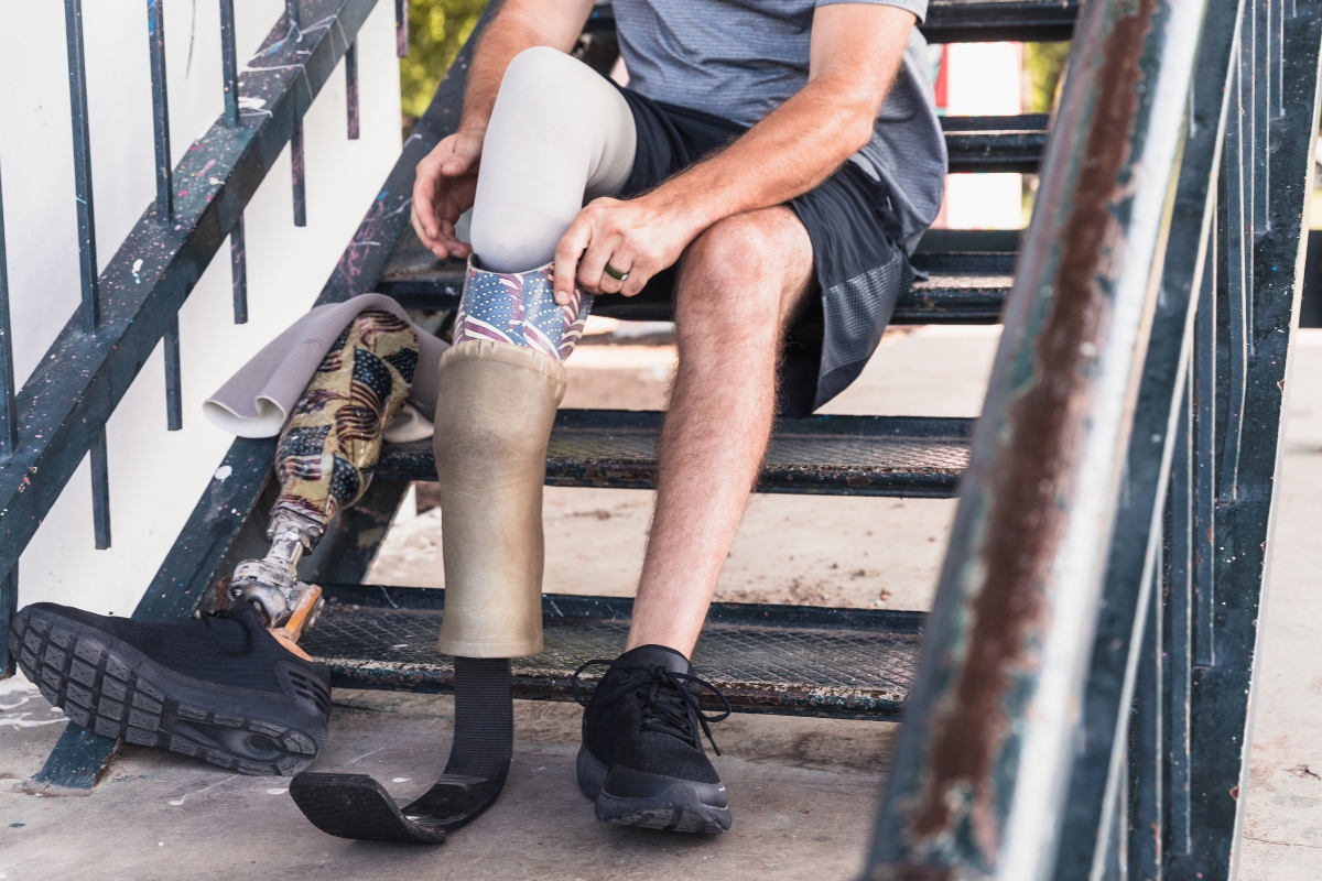 Patient switching from an everyday lower-leg prosthesis to a running prosthesis while seated