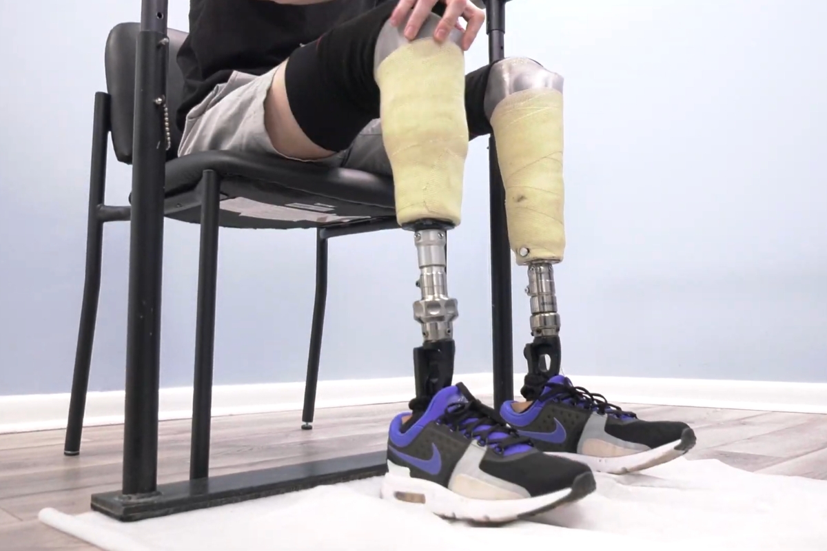 Lower-limb prostheses positioned with shoes during a prosthetic fitting appointment