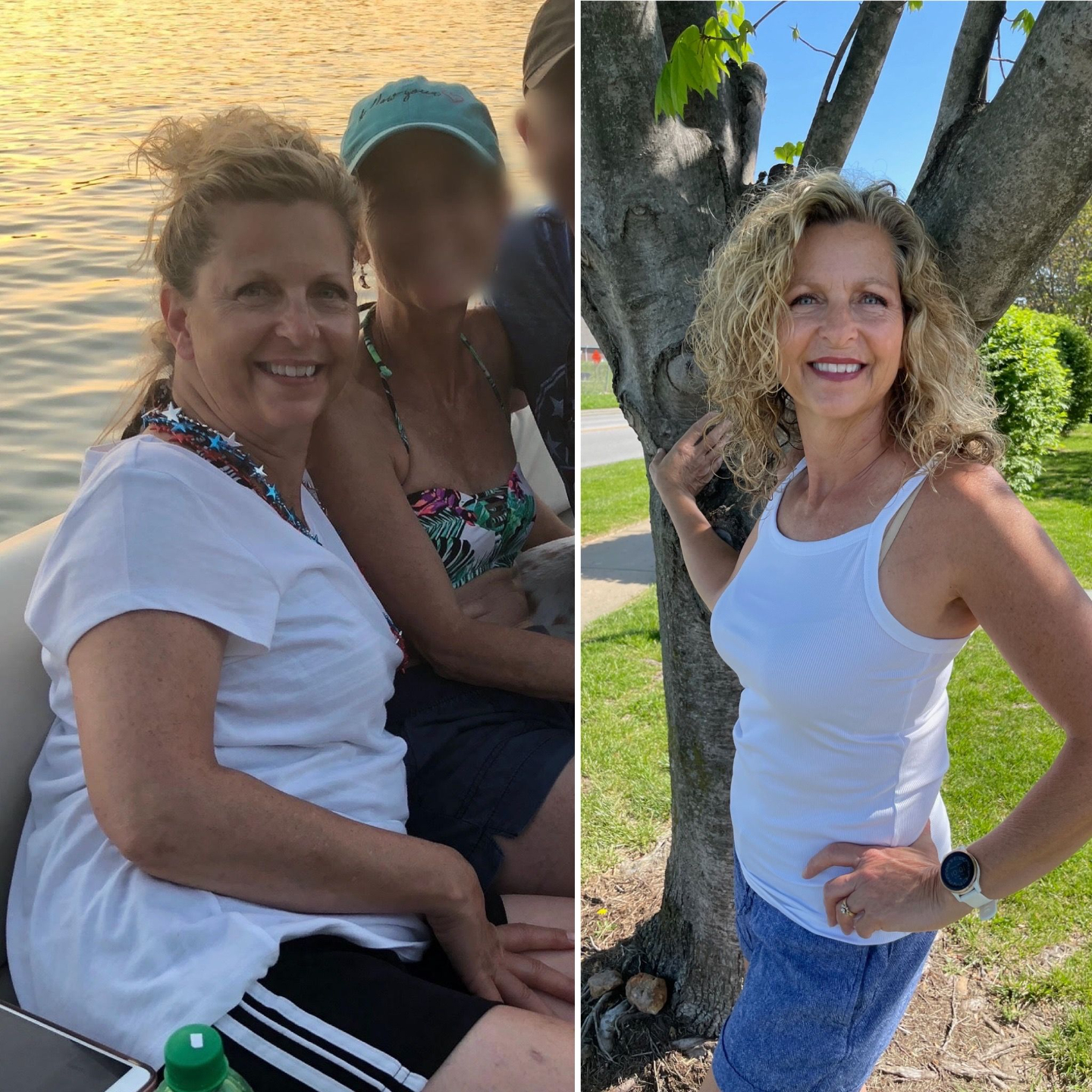 Dori before and after