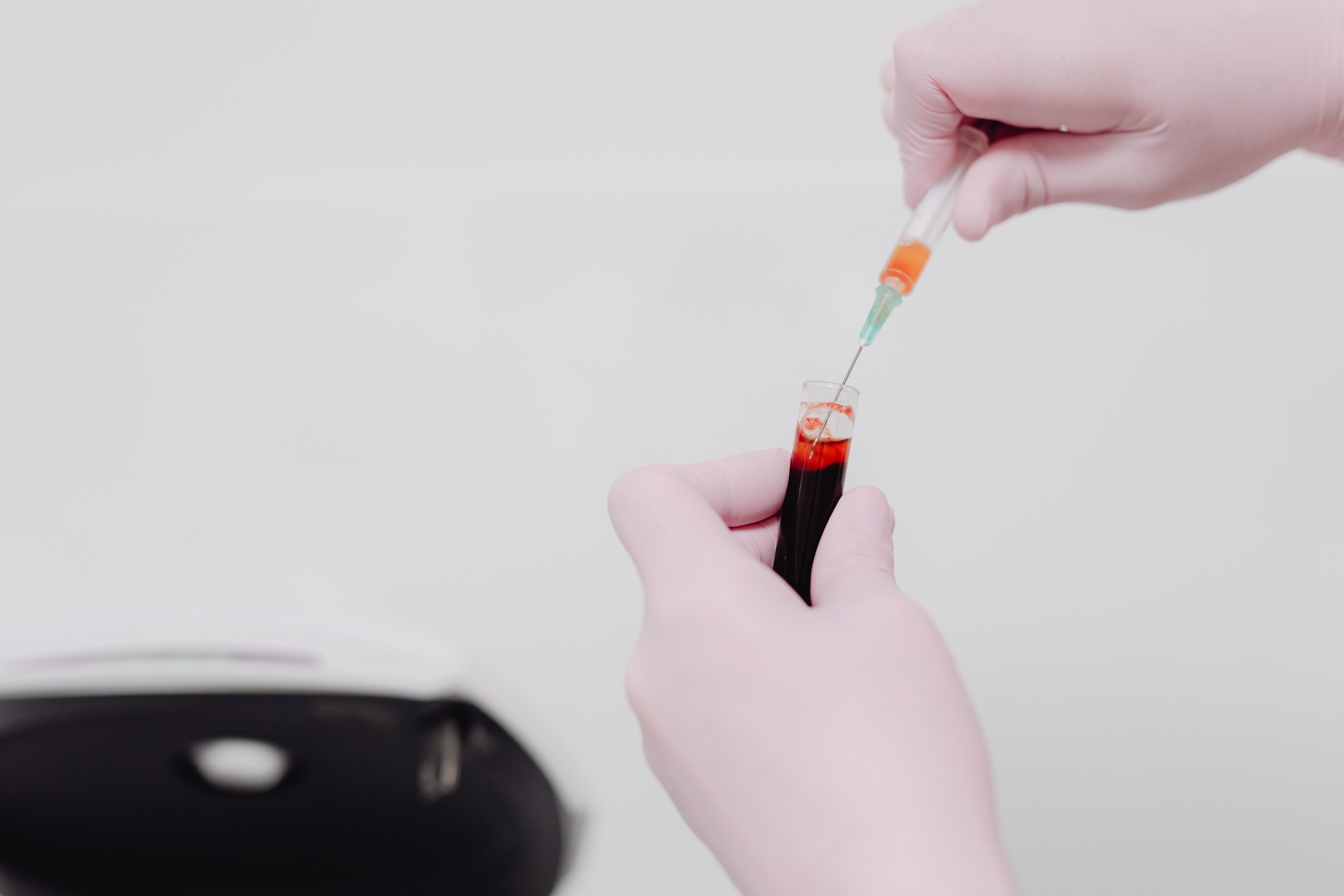 Blood and urine tests that detect kidney damage early