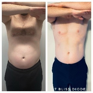 Before After 2