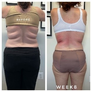Before After 2
