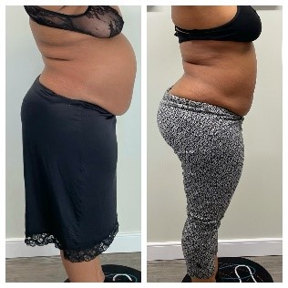 Before After 1