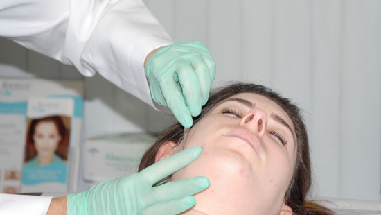 Dermaplaning