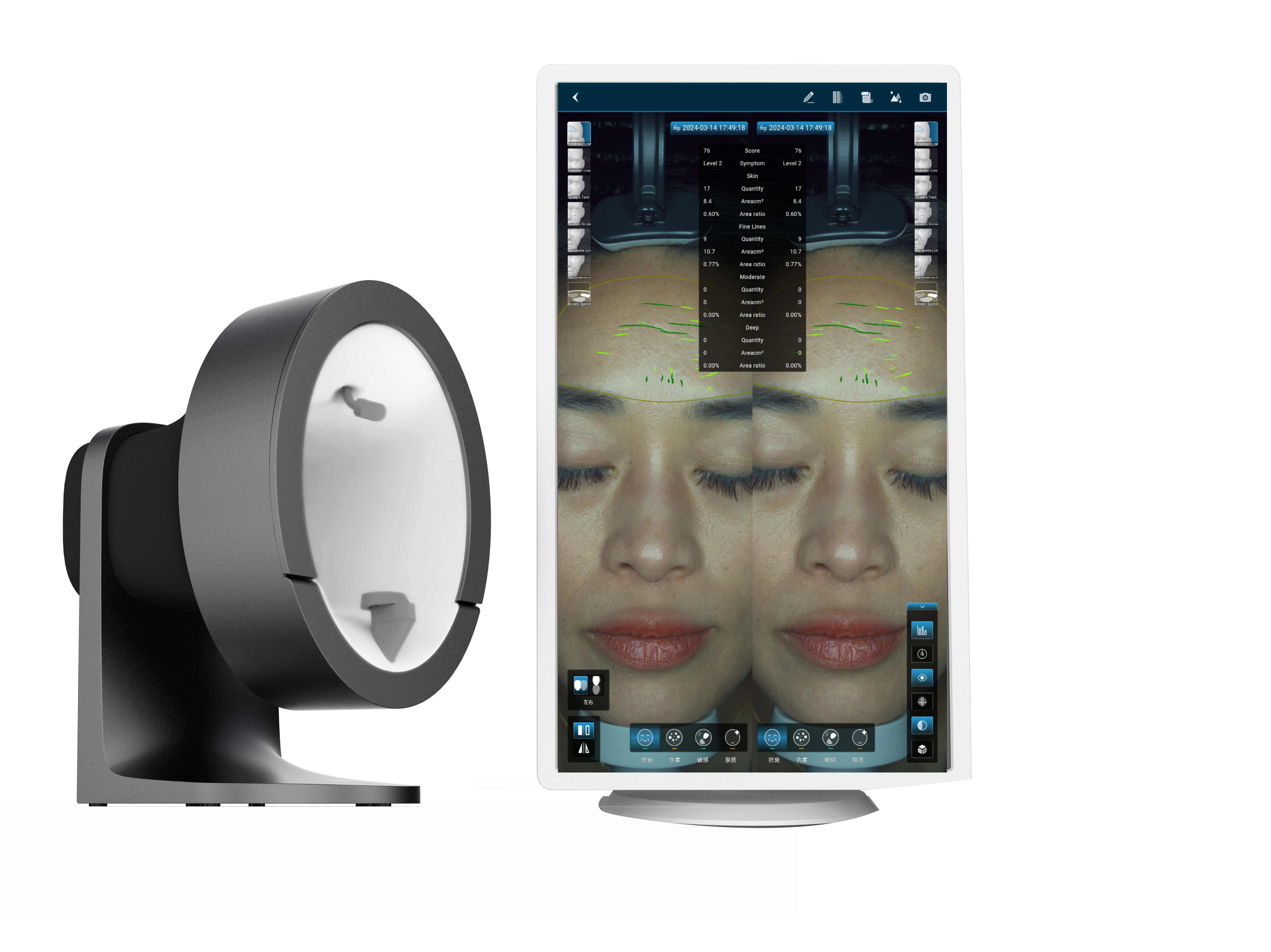 Pro-AI Skin Analyzer