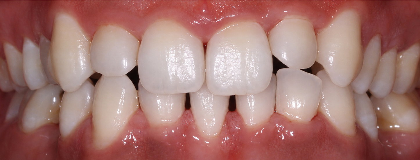 Integrity Dental Boston patient after treatment, bright full-width white smile, front-facing close-up
