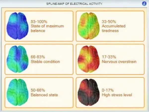 NeuralCheck spline map of electrical brain activity, from high stress to maximum balance