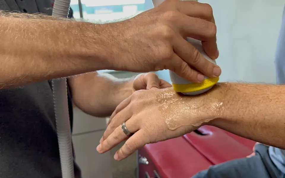 SoftWave treating wrist & hand pain