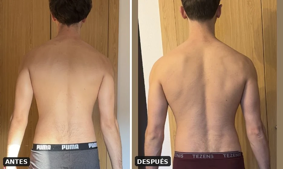 Antes y después de César