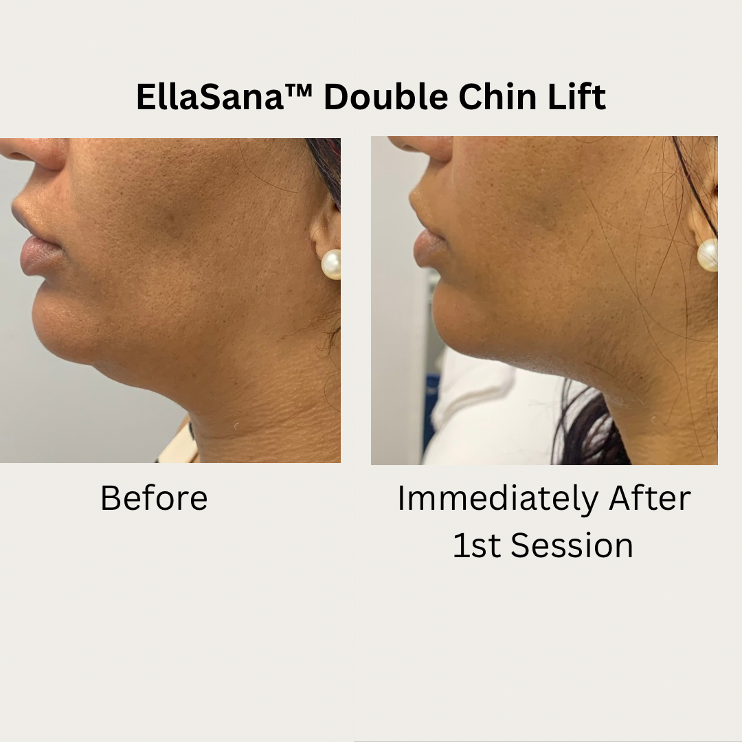 Verified EllaSana client review 8