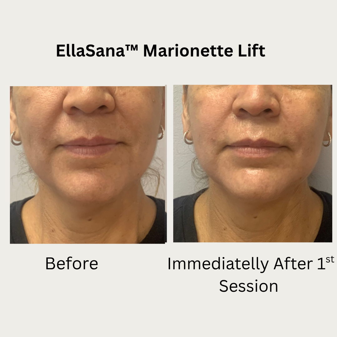 Verified EllaSana client review 9