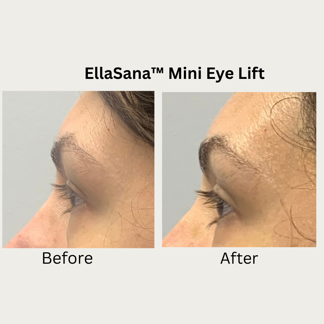 Verified EllaSana client review 11