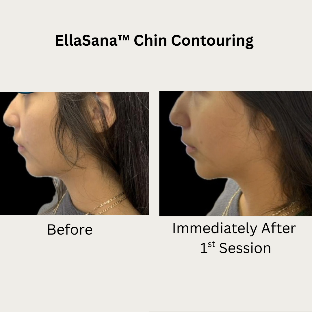 Verified EllaSana client review 2