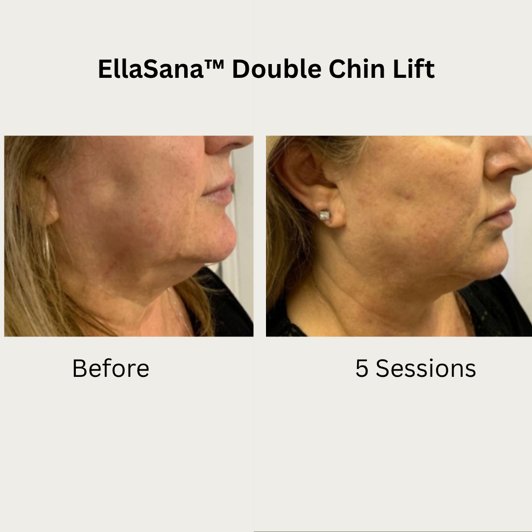 Verified EllaSana client review 4