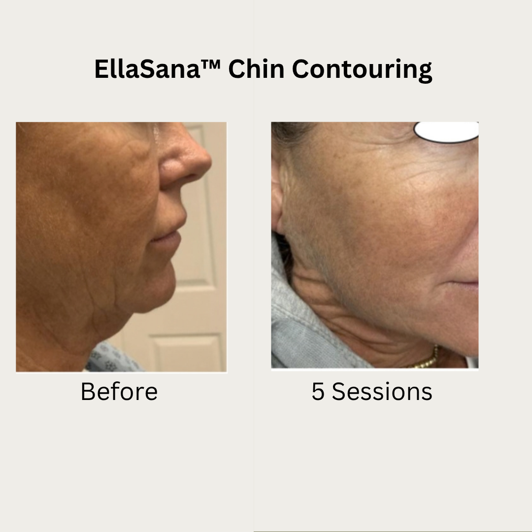 Verified EllaSana client review 1