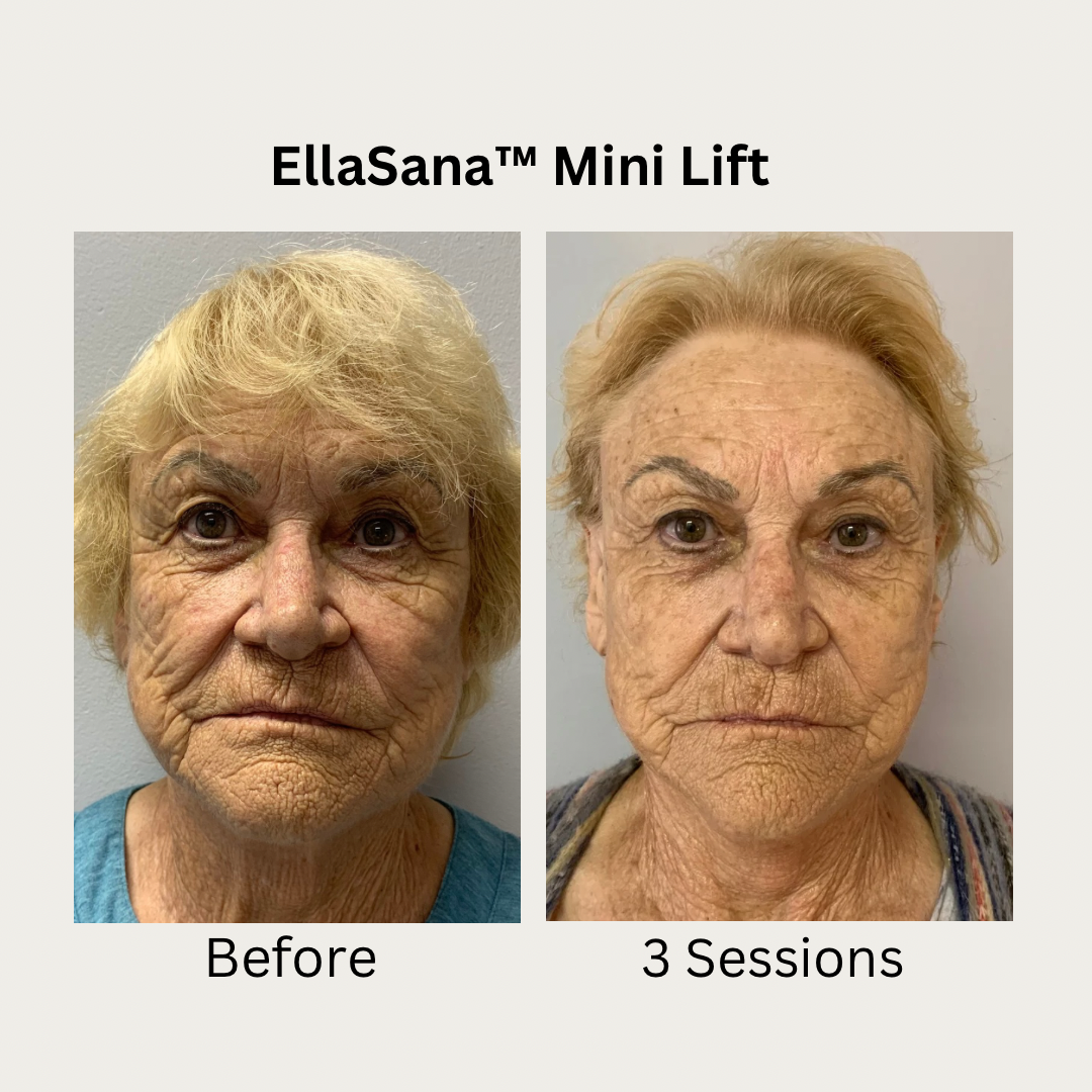 Verified EllaSana client review 7