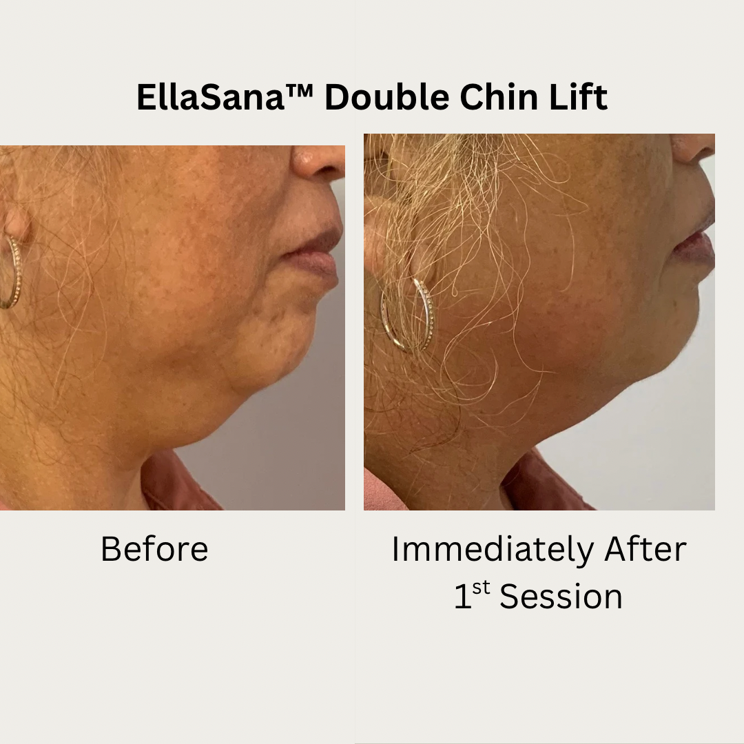 Verified EllaSana client review 5