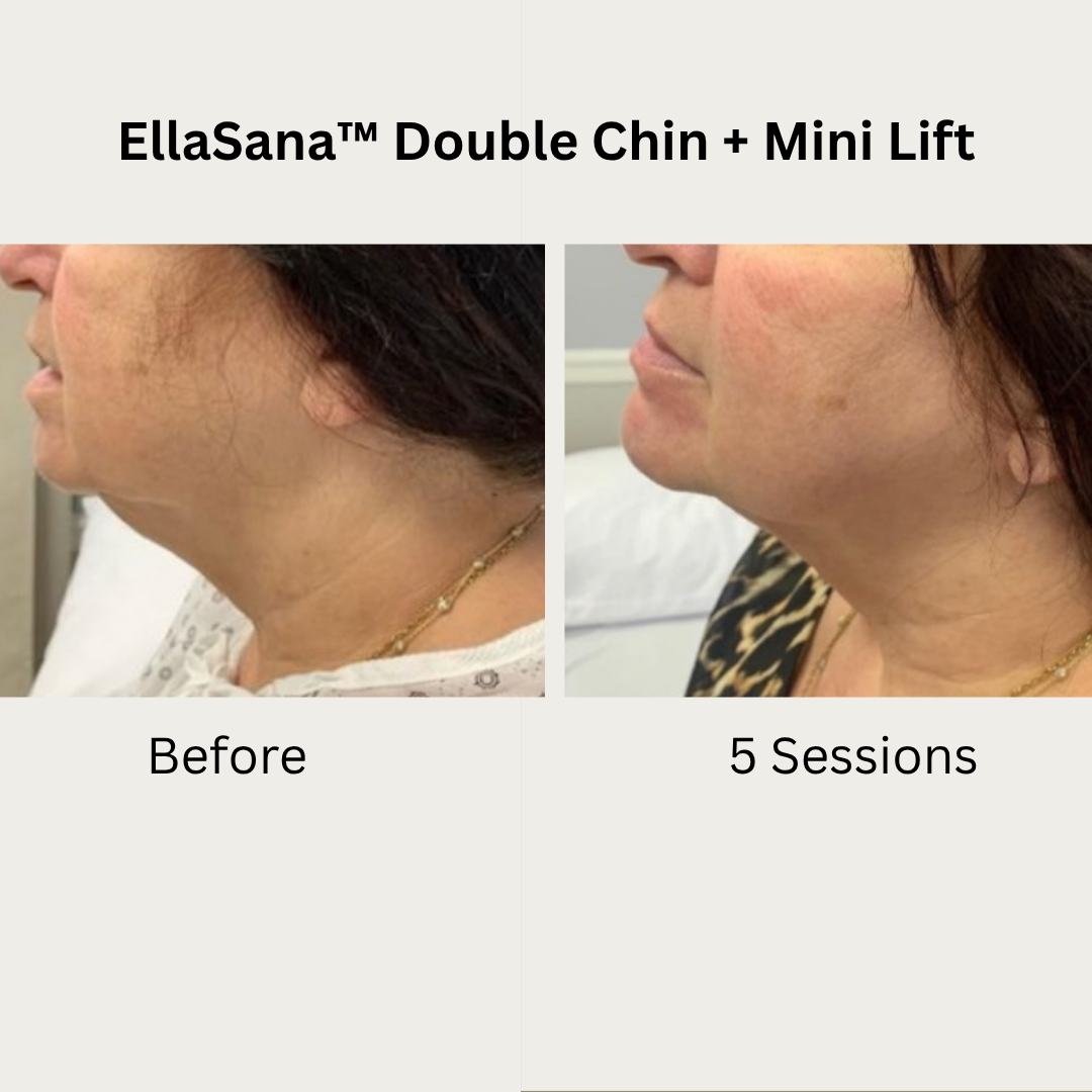 Verified EllaSana client review 3