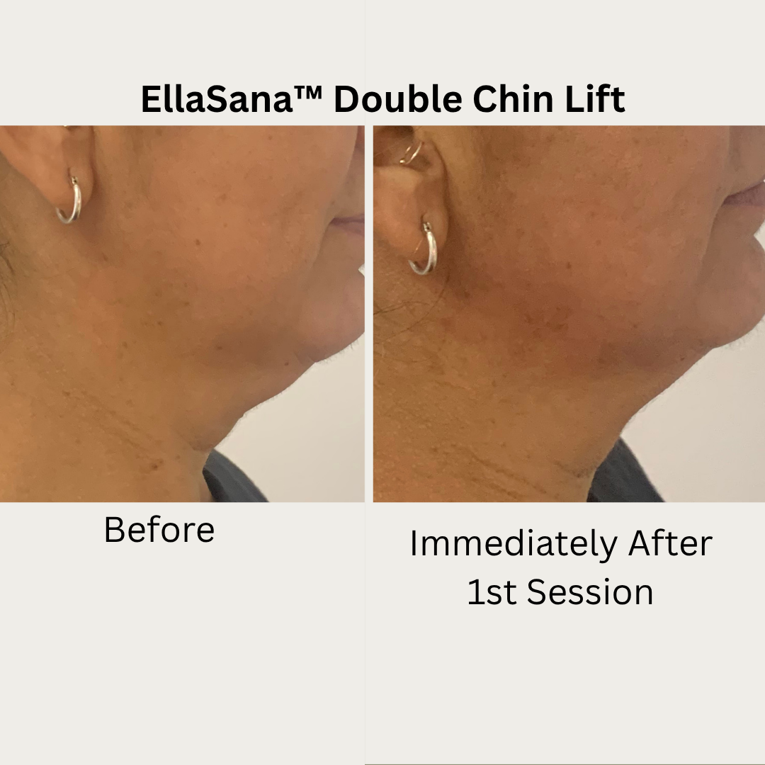 Verified EllaSana client review 6