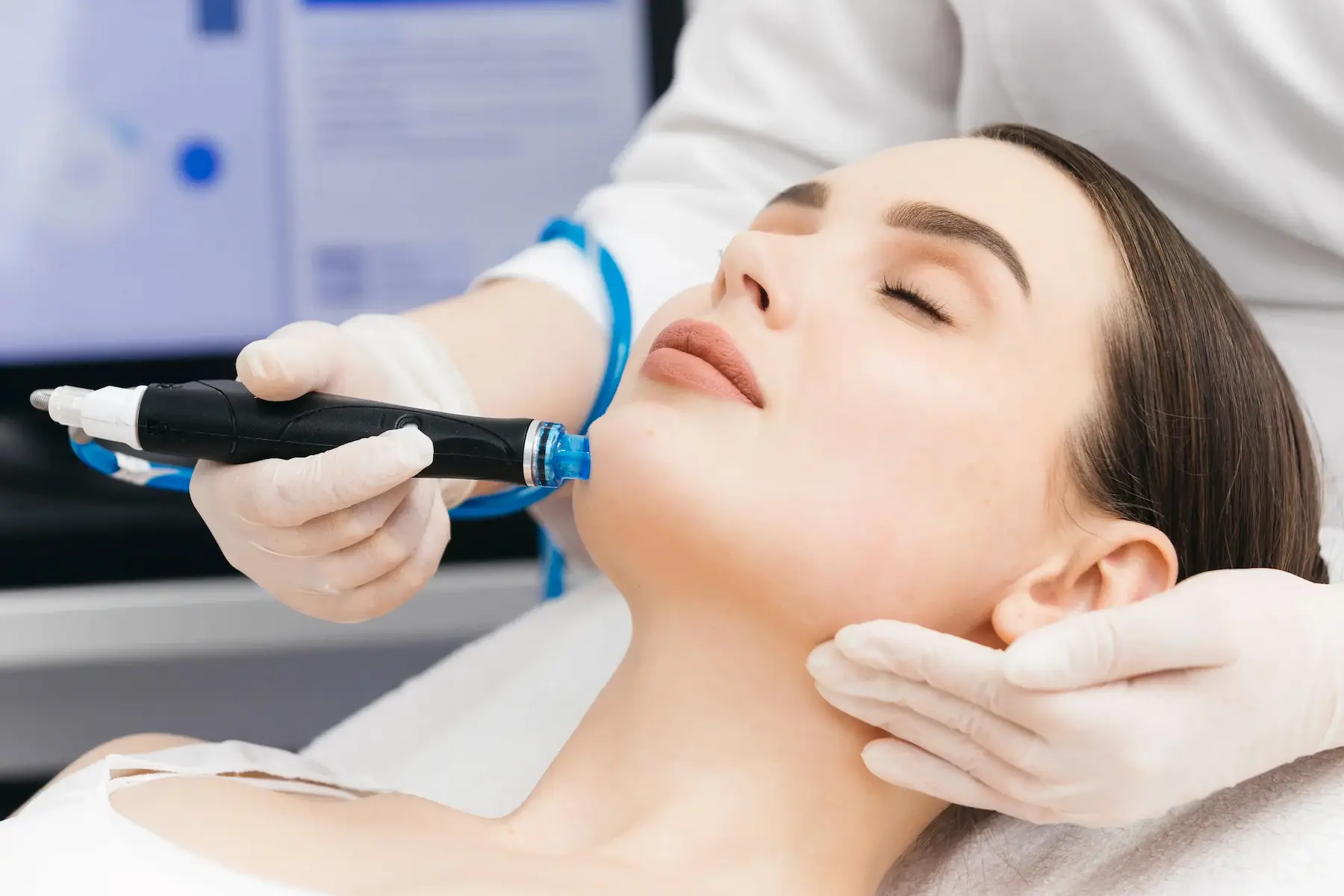 LyfeMedica Microneedling and PRP Resurfacing