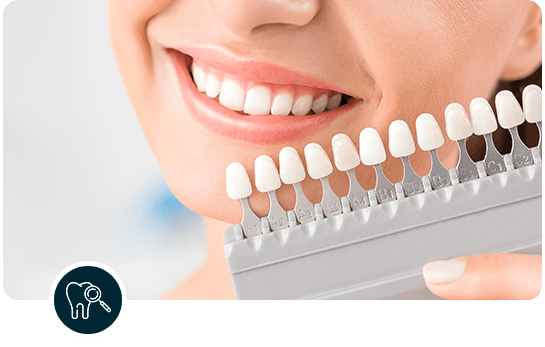 Smile Makeover