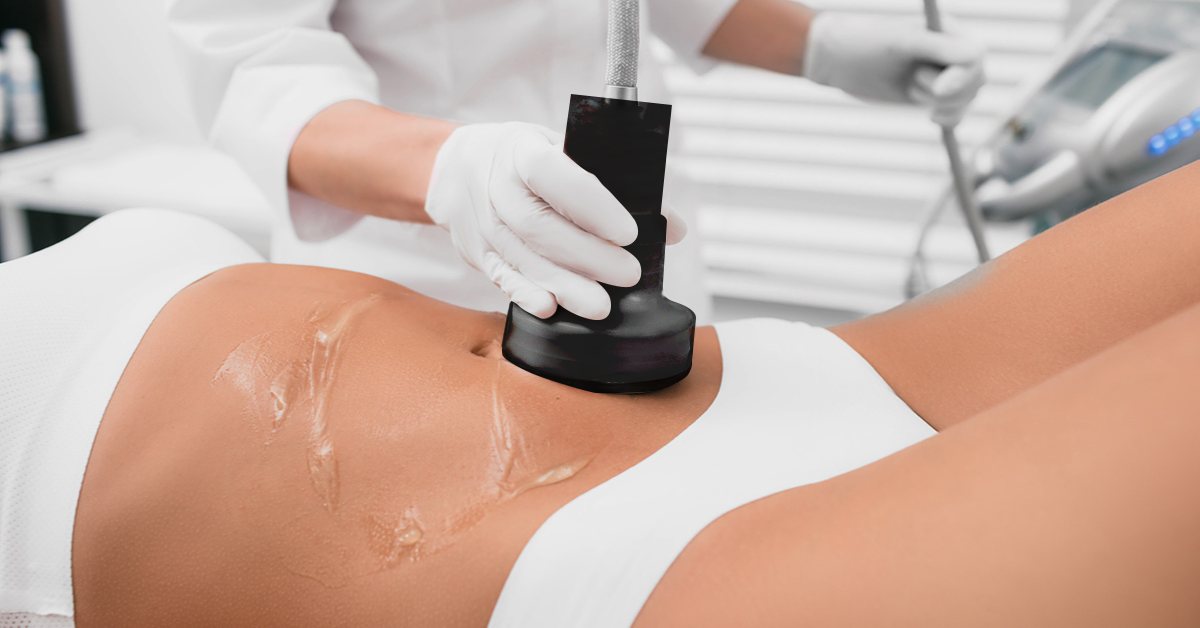 CellSound handpiece during a body treatment