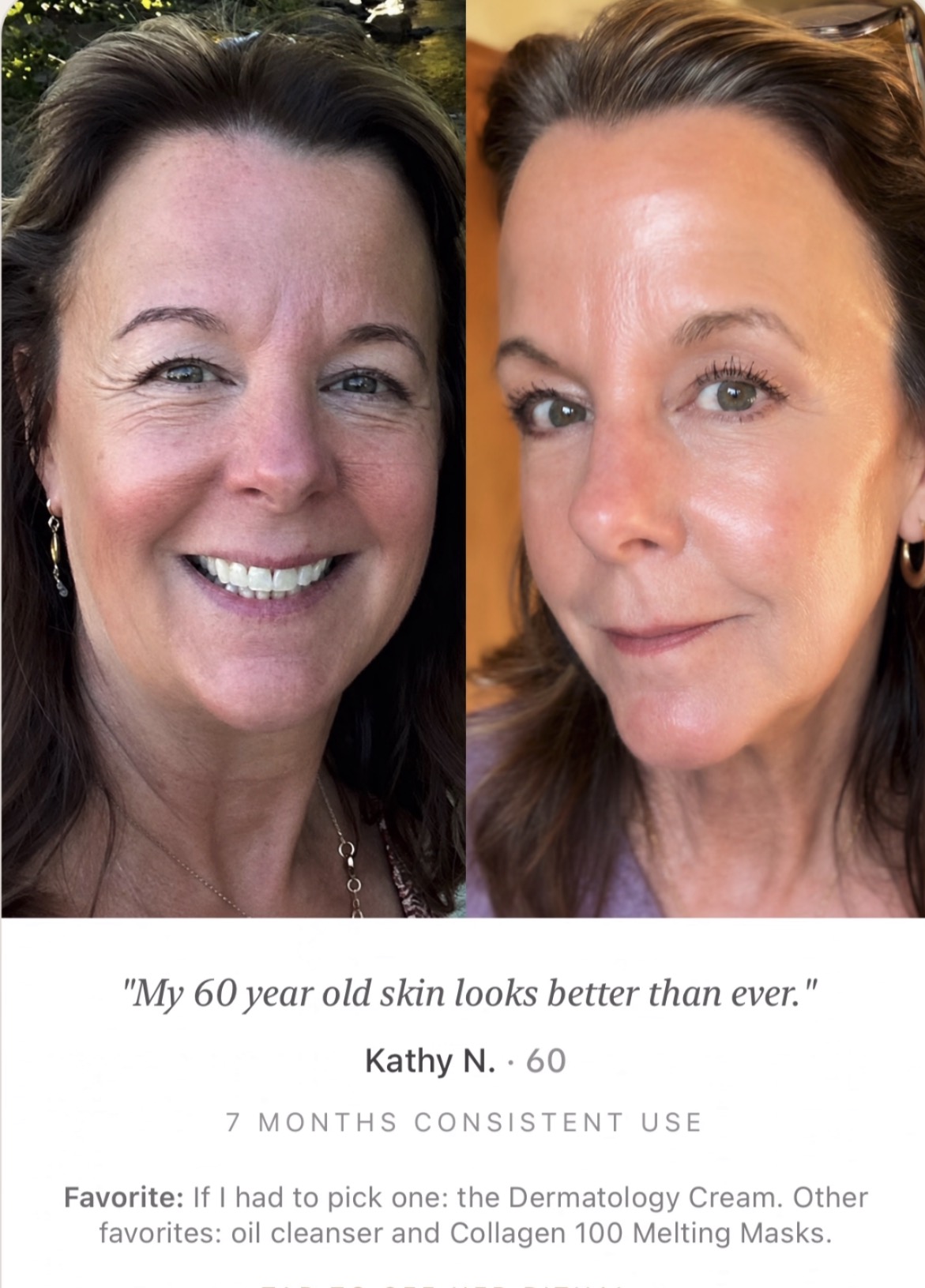 Kathy’s before and after photos, seven months apart
