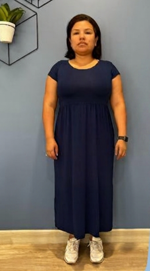 Paciente antes de la cirugía