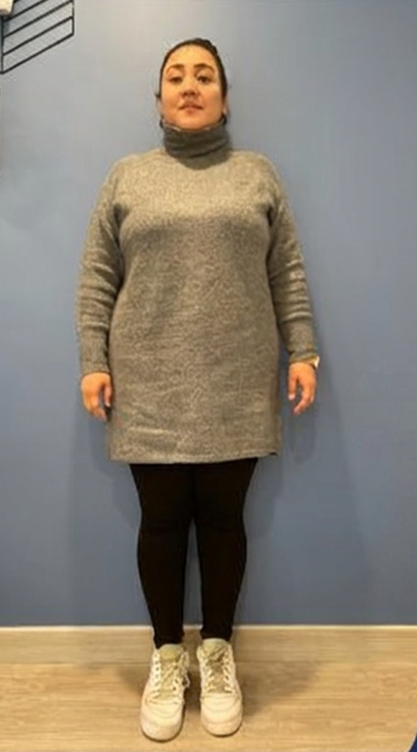 Paciente antes de la cirugía