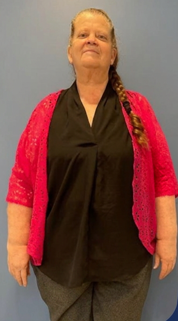 Paciente antes de la cirugía