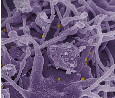 Eje Intestino-Ojo