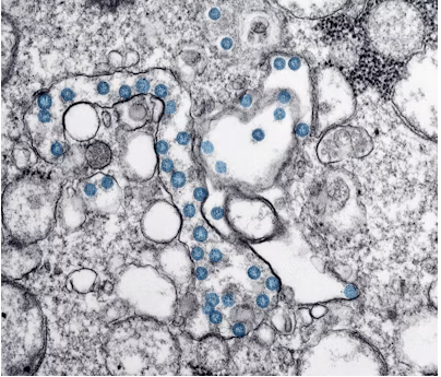 Inflamasoma y Envejecimiento Ocular