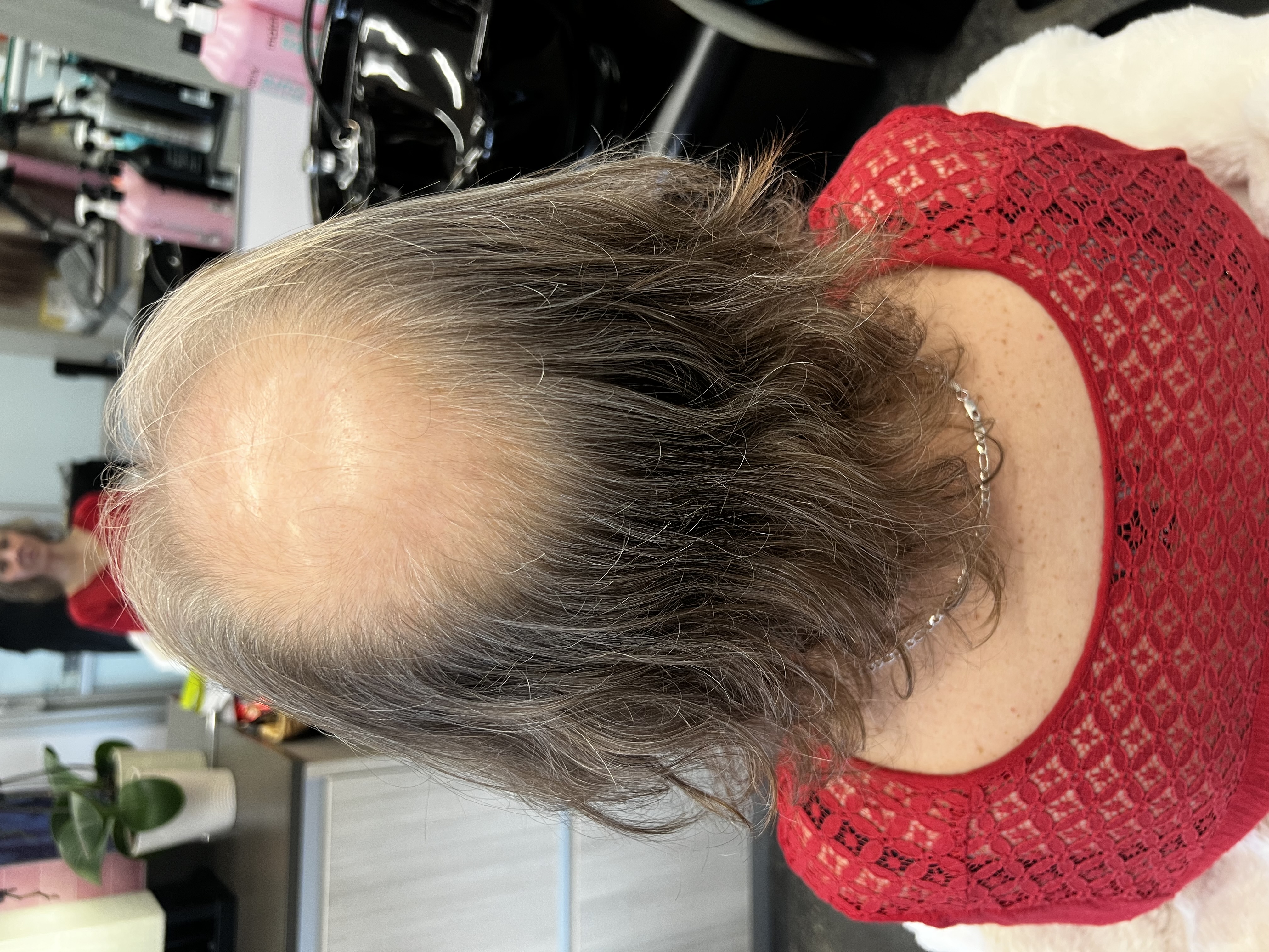 thinning hair thinning hair