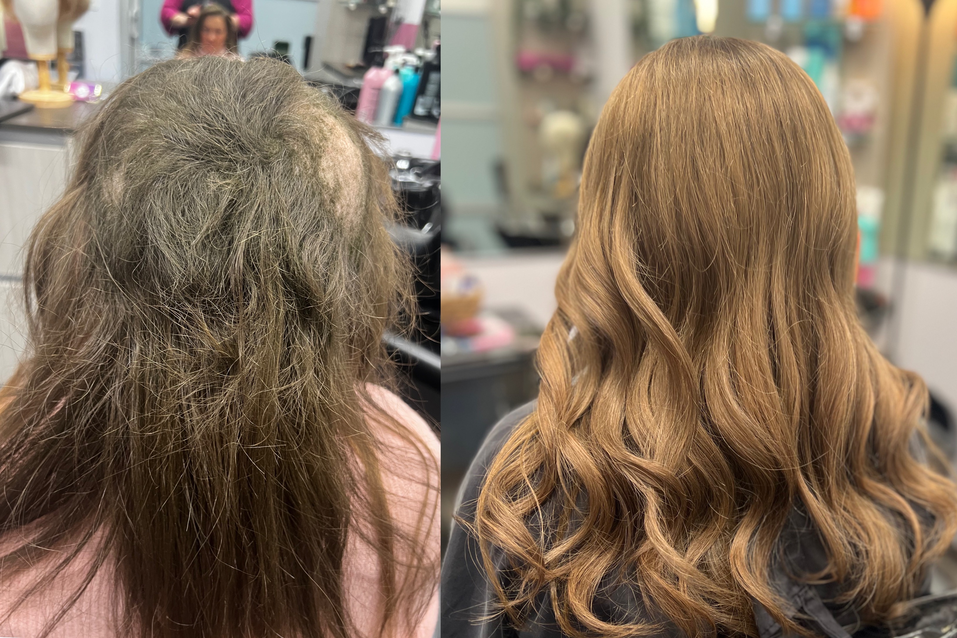 Topper Hair Example Topper Hair Example