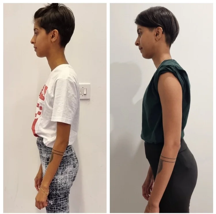 Client before and after 7