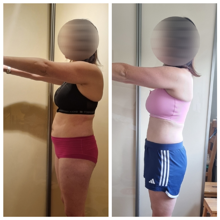 Client before and after 20