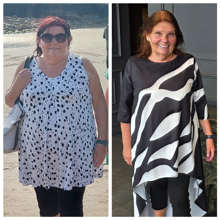 Client before and after 17