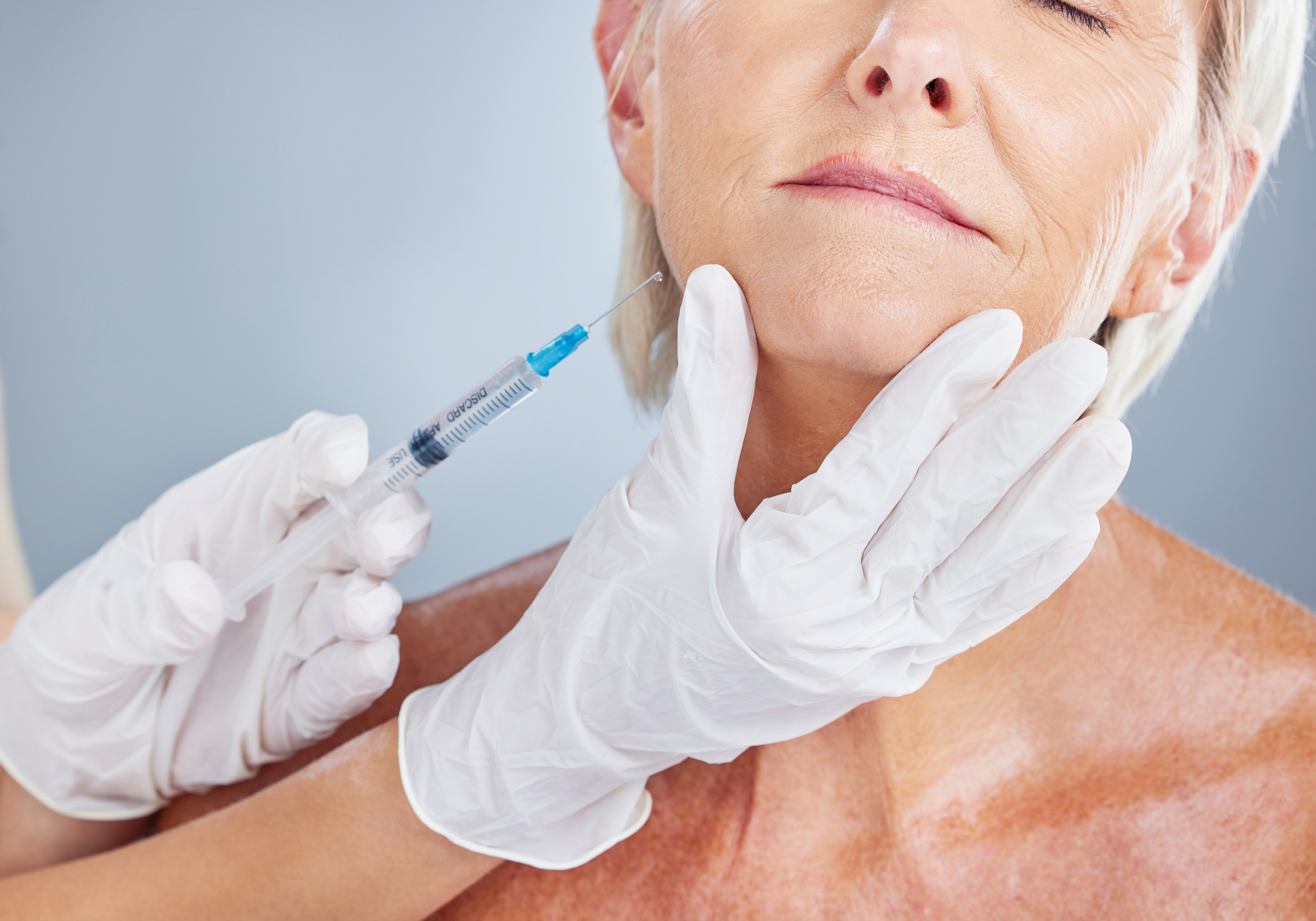 Rappresentazione del muscolo massetere e area di iniezione botox