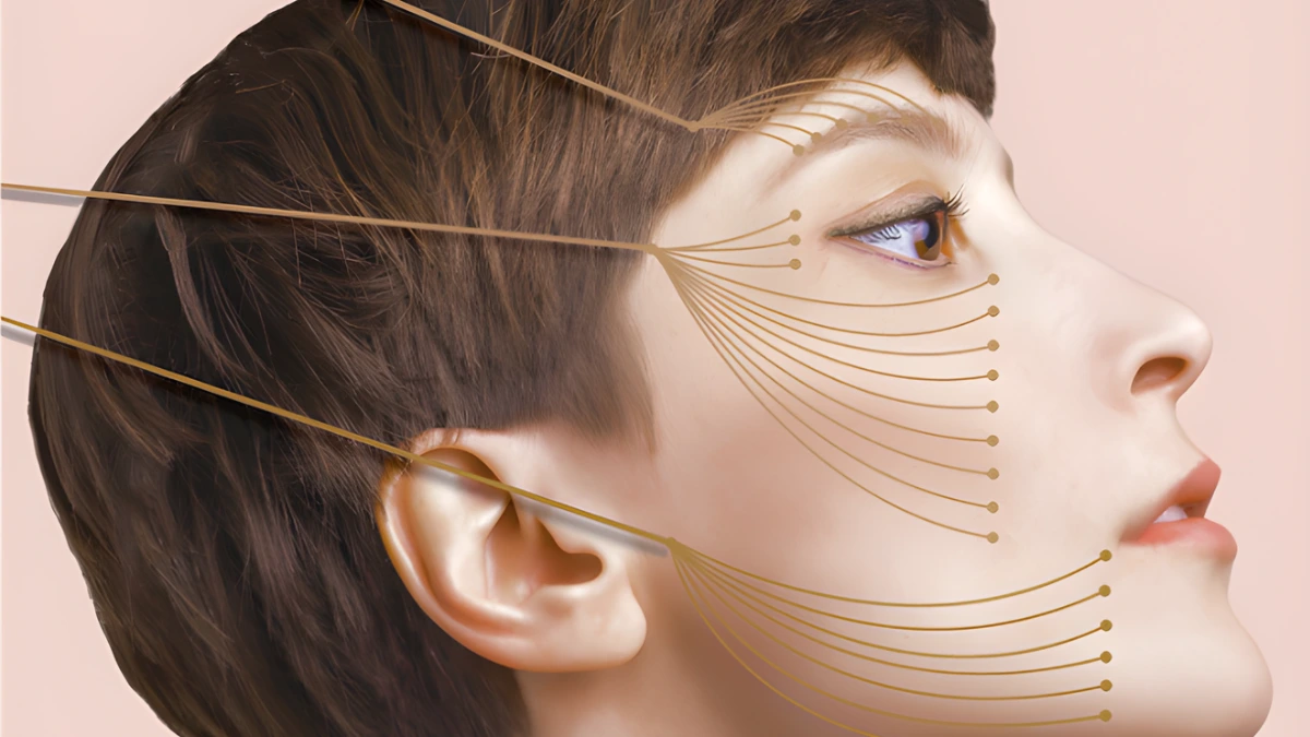 Turn back time with APTOS Thread Lift in Dubai by Dr Mayur Bhobe. Best non-surgical face lift for tightening & contouring.