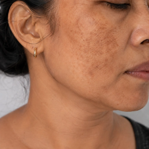 Spot early skin abnormalities and know when to consult an expert. Trusted guidance by Dr Mayur Bhobe on skin changes and timely medical help.