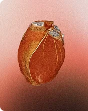 Heart health