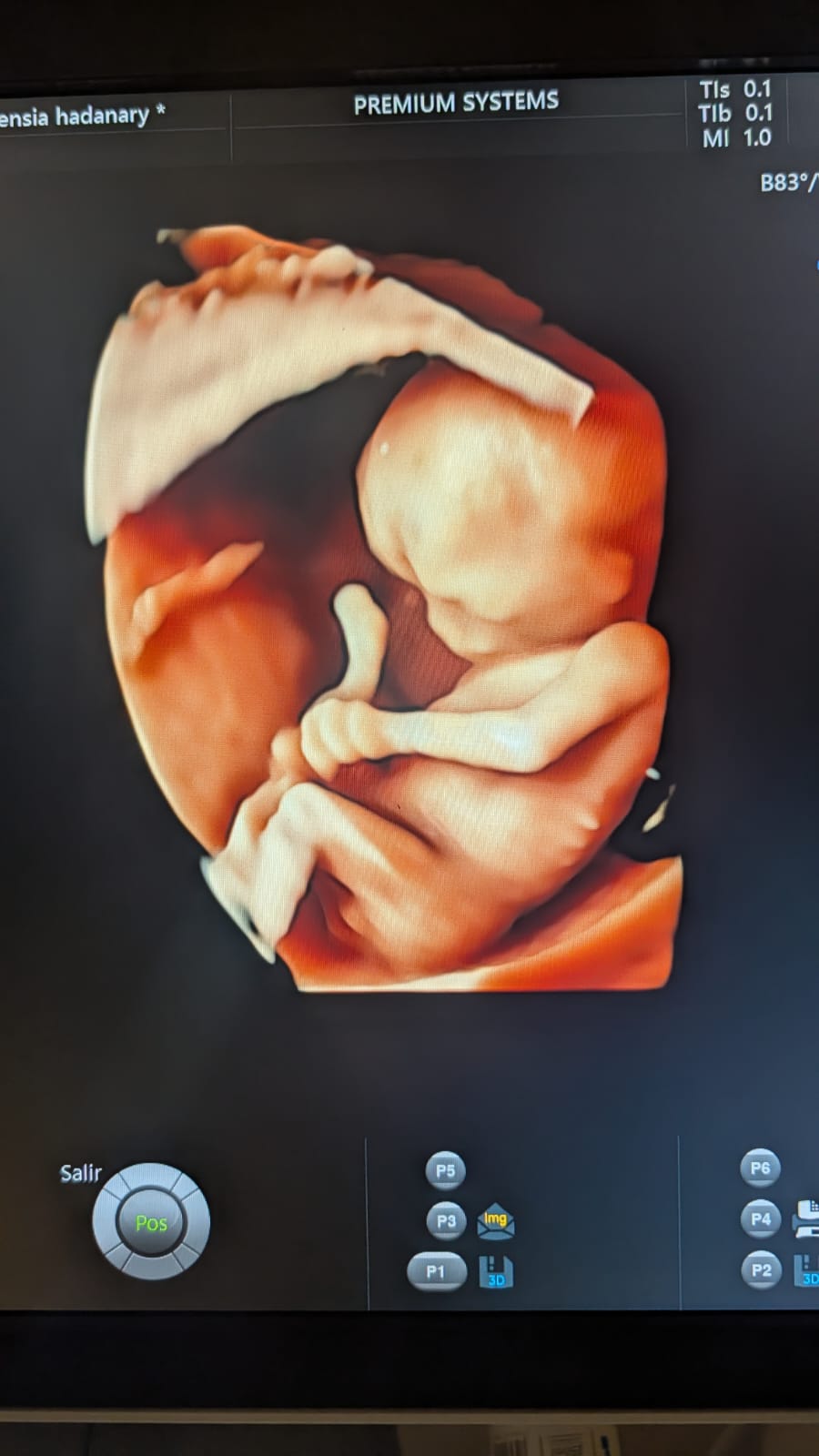 Imagen fetal - Medicina Materno Fetal