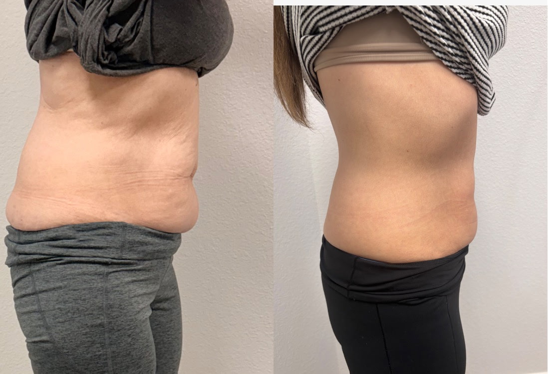Client before and after result